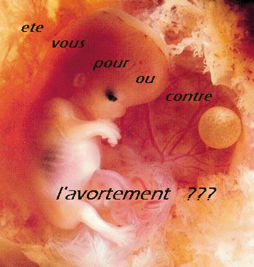 repond repond???????????????????